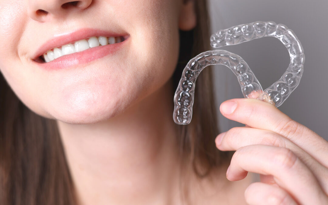 Clear Aligners: The Battle for Our Smiles